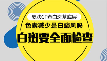 伍德灯检查白斑是不是白癜风颜色对照表