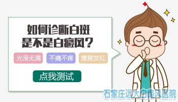 什么方法能够验证白斑是不是白癜风