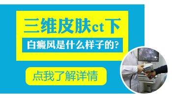 皮肤检测仪式照一照就知道是白癜风吗