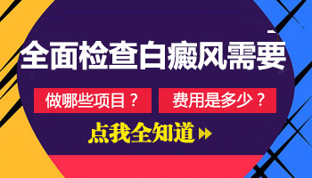 白癜风做体检能检查出来吗