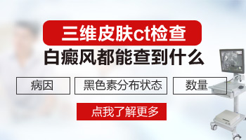 伍德灯检查白斑是不是白癜风会误诊吗