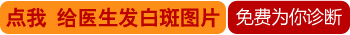 孕晚期肚子长白斑表面光滑是不是白癜风