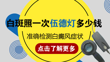 伍德灯检查白癜风为什么每个医院定价不一样