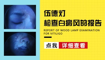 宝宝身上好多小白斑但在wood灯下不太明显是白癜风吗