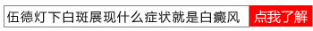 伍德灯下浅白色的白点会不会是白癜风