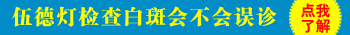 7个多月的宝宝身上有白点能照伍德灯吗