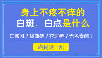 脖子下发白是不是得了白癜风