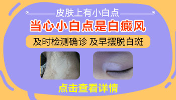 宝宝大腿上有个白色斑点图片