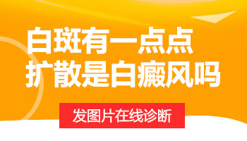 白斑扩散是不是白癜风