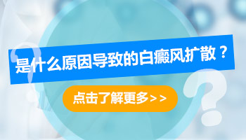 白癜风照308刚好点一个月后又扩散了是为什么