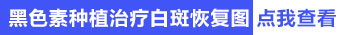 白癜风扩散期还能稳定吗 从扩散到稳定需要多长时间