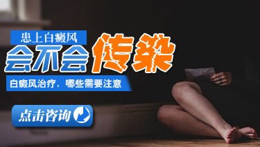 头部白癜风特性是怎样的