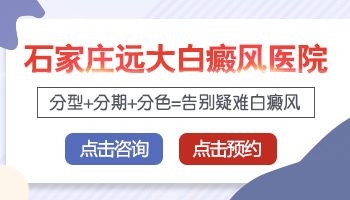 太阳穴的地方长白斑有2年了怎么治