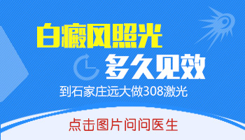 进口308激光照白癜风几次有效果