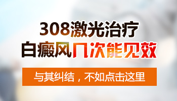 白癜风大概做308激光几次见效