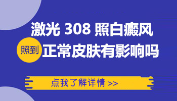 308光照白癜风后脱皮是正常的吗