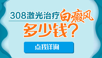 激光照一次白癜风大概多少钱 308贵不贵