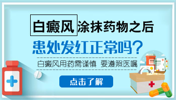 白癜风做了308多久可以涂药