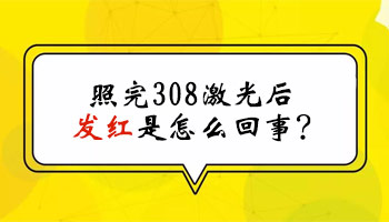 白癜风照了308激光皮肤发红一般多长时间能消下去