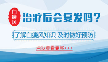 如何治疗白癜风 白斑做光疗有效果吗