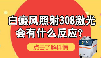 白癜风照完激光疼痛发红是正常现象吗