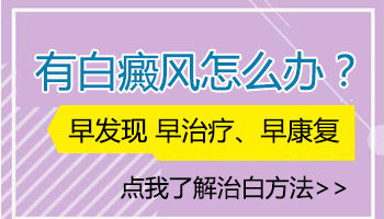 手上和脚上的白癜风怎么治才能治好