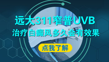 uvb能照肚子上的白癜风吗