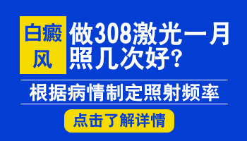 白癜风三天照射一次308激光可以吗