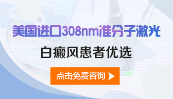 眼角长白癜风能用308照吗