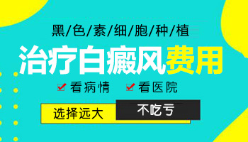 黑色素种植治疗白癜风需要多少钱