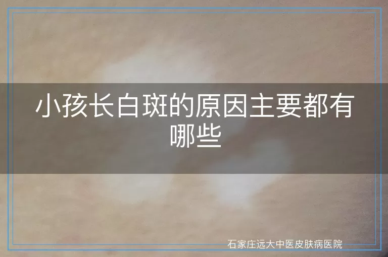 小孩长白斑的原因主要都有哪些