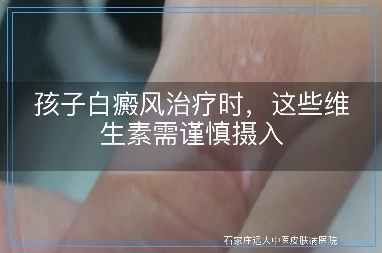 孩子白癜风治疗时，这些维生素需谨慎摄入