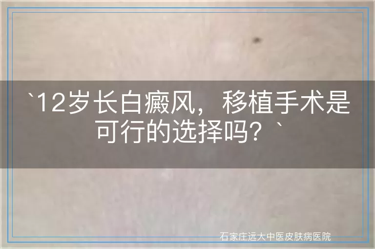 `12岁长白癜风，移植手术是可行的选择吗？`