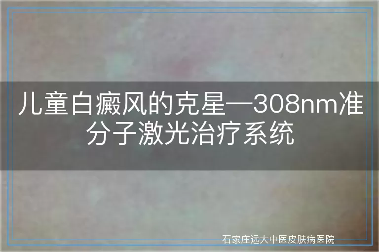 儿童白癜风的克星—308nm准分子激光治疗系统