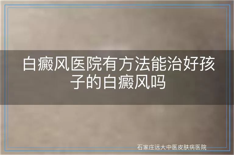 白癜风医院有方法能治好孩子的白癜风吗