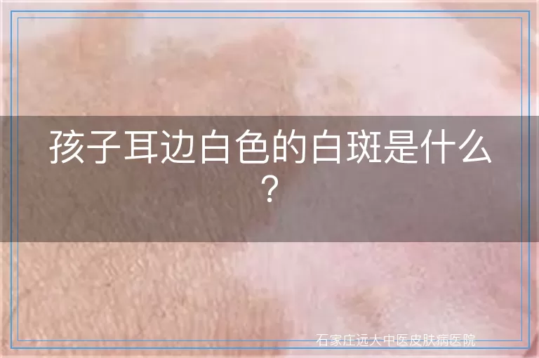 孩子耳边白色的白斑是什么？