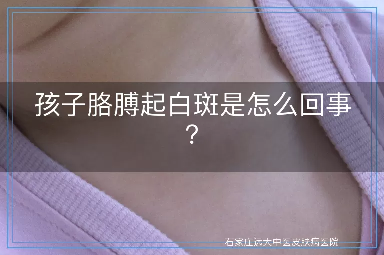 孩子胳膊起白斑是怎么回事？