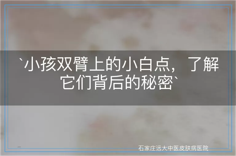 `小孩双臂上的小白点，了解它们背后的秘密`