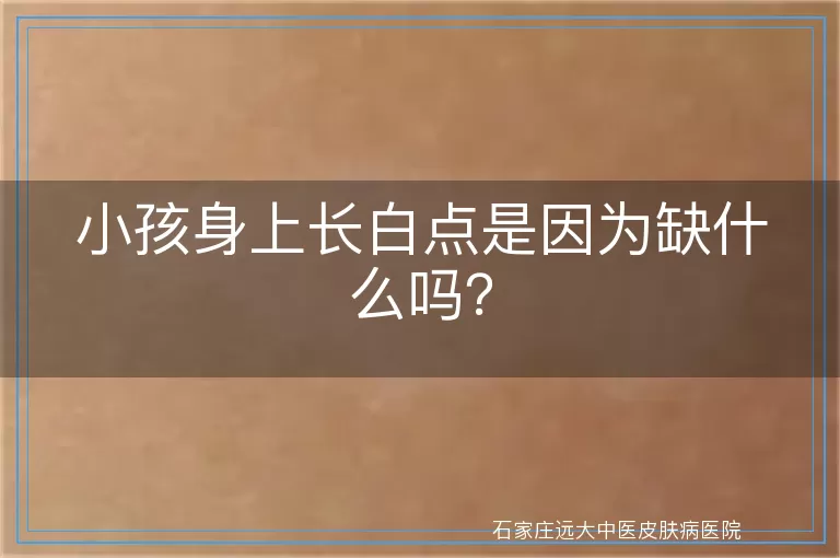 小孩身上长白点是因为缺什么吗？