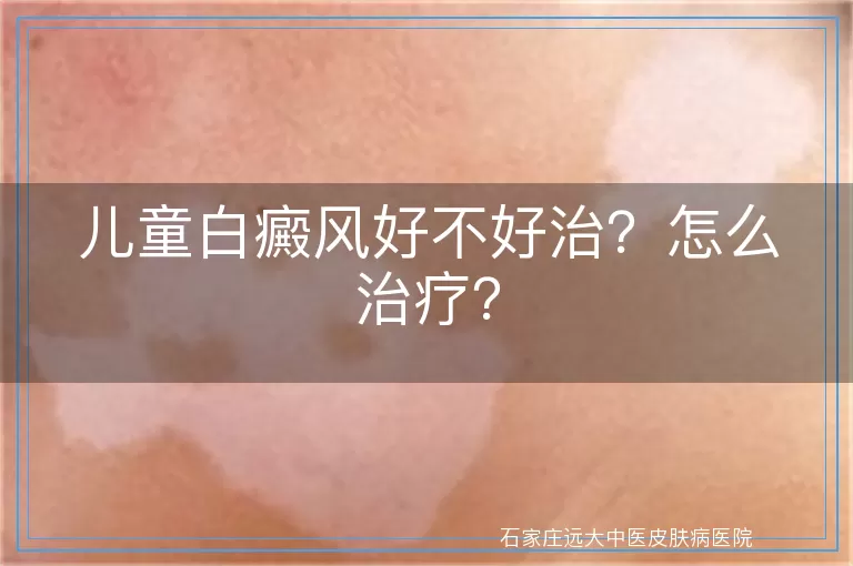 儿童白癜风好不好治？怎么治疗？