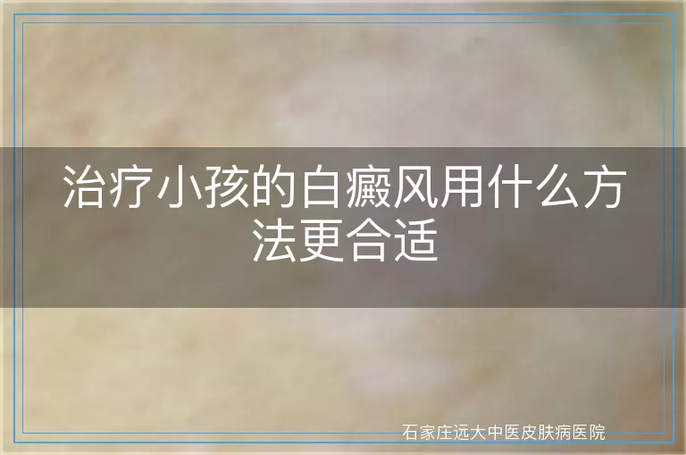 治疗小孩的白癜风用什么方法更合适