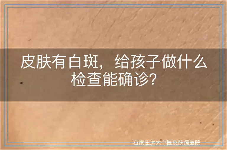 皮肤有白斑，给孩子做什么检查能确诊？