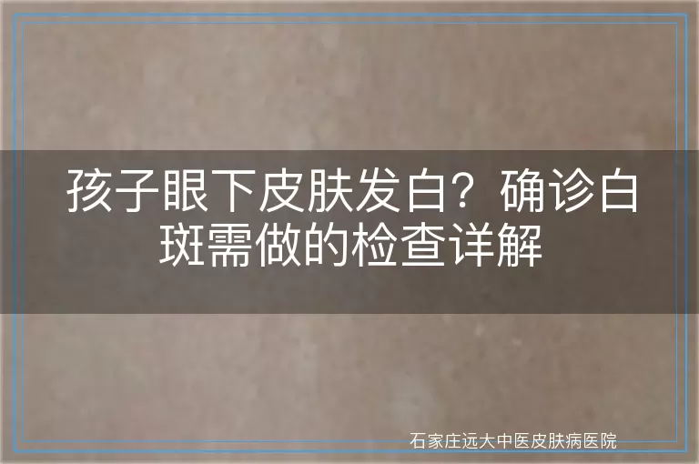 孩子眼下皮肤发白？确诊白斑需做的检查详解