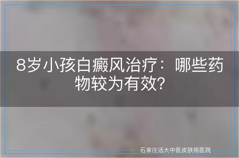 8岁小孩白癜风治疗：哪些药物较为有效？