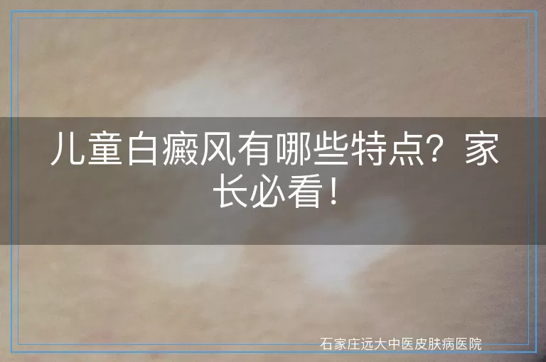 儿童白癜风有哪些特点？家长必看！