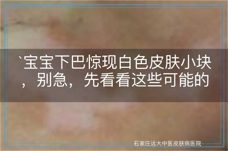 宝宝下巴惊现白色皮肤小块，别急，先看看这些可能的原因！