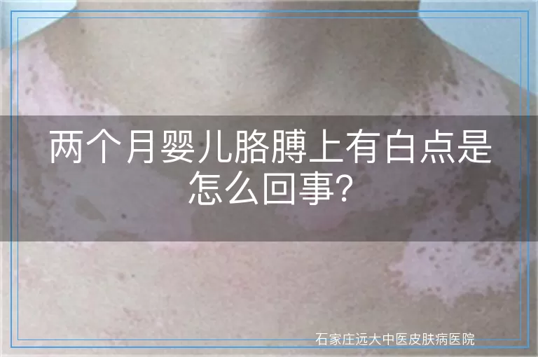 两个月婴儿胳膊上有白点是怎么回事？