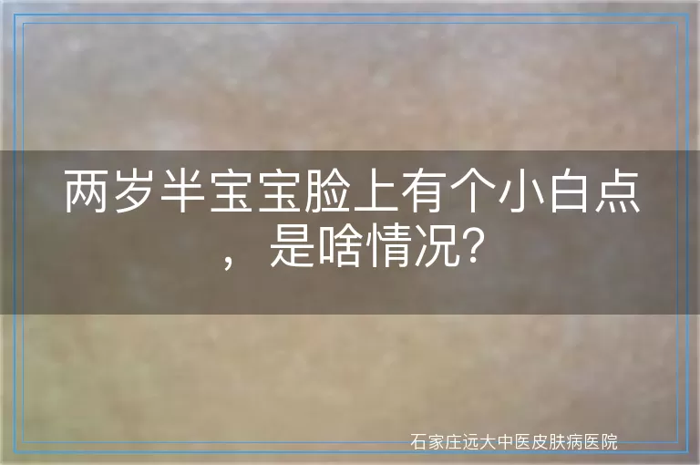 两岁半宝宝脸上有个小白点，是啥情况？