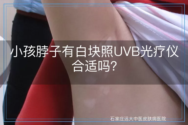 小孩脖子有白块照UVB光疗仪合适吗？