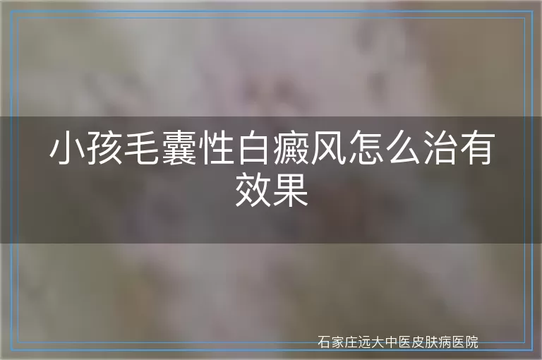 小孩毛囊性白癜风怎么治有效果